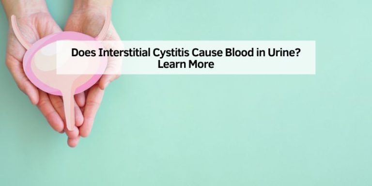 Does Interstitial Cystitis Cause Blood in Urine