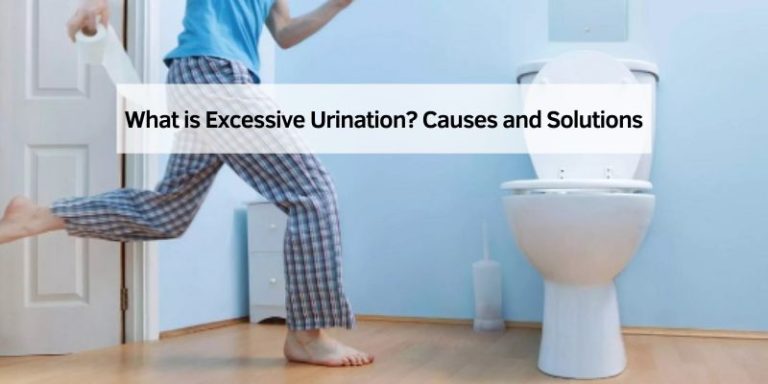 What is Excessive Urination