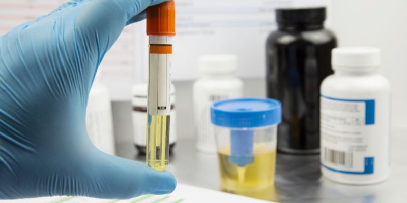 Can Alcohol Directly Cause Foamy Urine