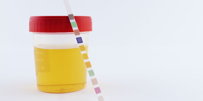 Diet and Its Impact on Urine Clarity