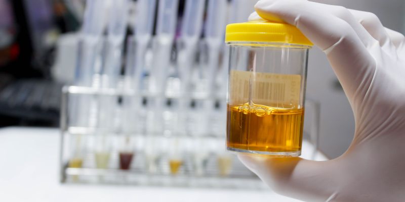 Does Alcohol Cause Foamy Urine