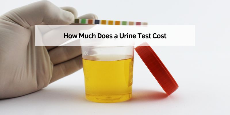 How Much Does a Urine Test Cost