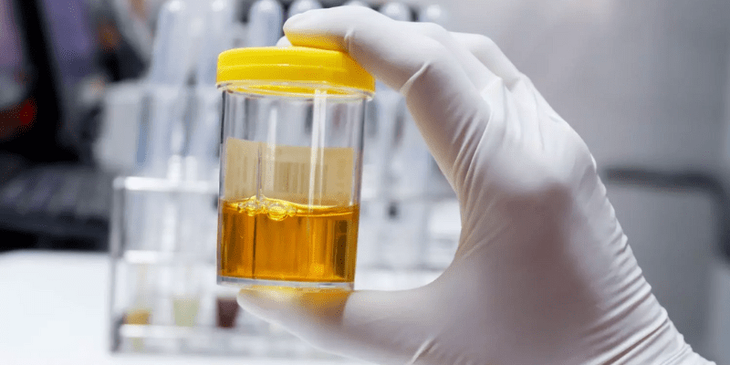 How Urine Tied to Automotive Health