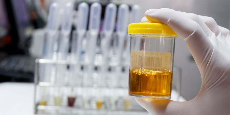 How to Keep Your Urine Normal