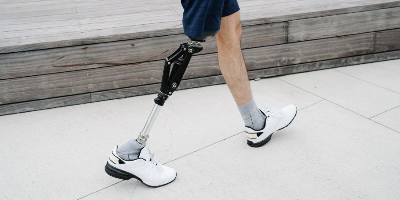 My Journey with Leg Coverage