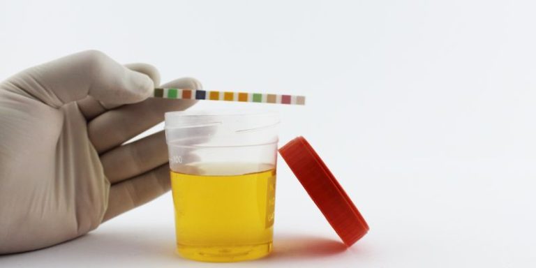 Understanding How Many Times a Diabetic Urinates