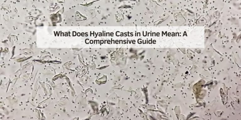 What Does Hyaline Casts in Urine Mean
