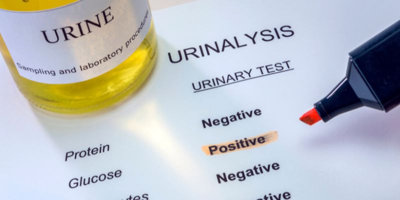 What Is a Urine Test For