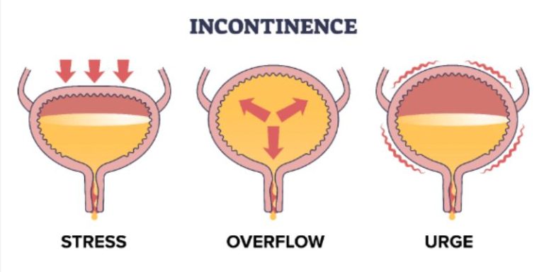 Why Am I Leaking Urine