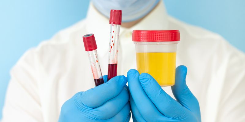 How Long Does Weed Stay in Your System?