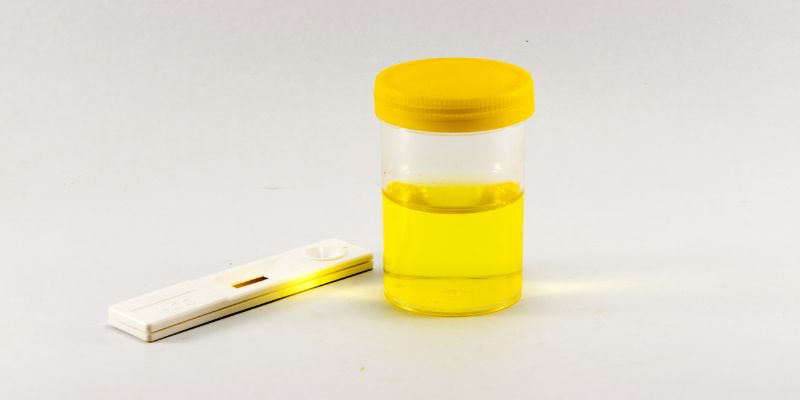 How Are White Blood Cells Detected in Urine