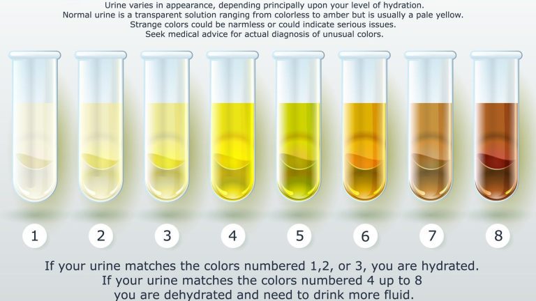 What Does Your Urine Look Like When Pregnant