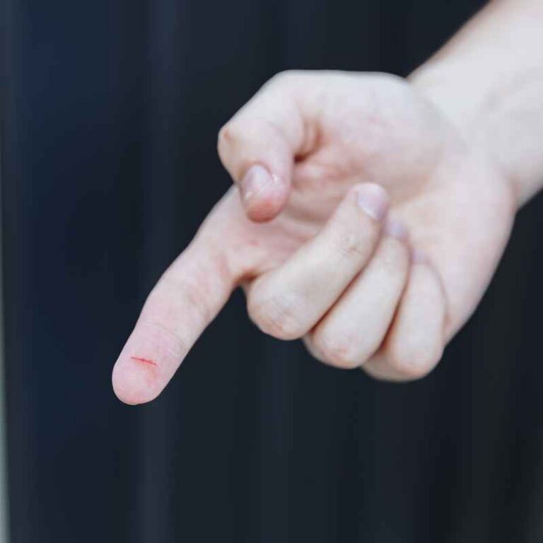 Is It Dangerous To Superglue A Cut On Your Finger?