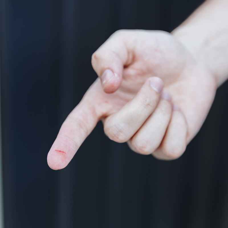 Is It Dangerous To Superglue A Cut On Your Finger?