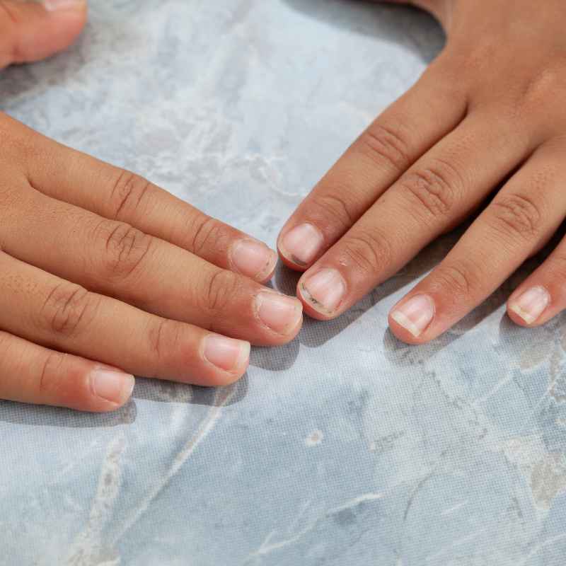 Quick Tips for Finger Cut Care